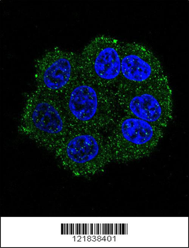 TMPRSS3 Antibody (Center)