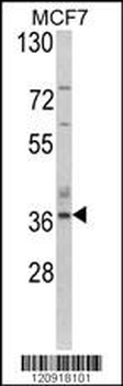 ASPA Antibody (N-term)