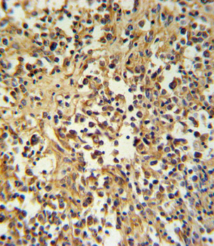 GZMM Antibody (Center)