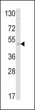 EDNRB Antibody (C-term)