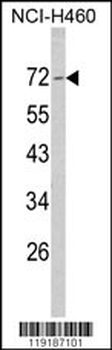 Merlin Antibody (N-term)