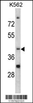 CCRN4L Antibody (C-term)