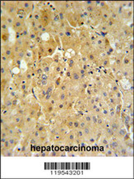 P450R Antibody (Center)