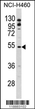 BLNK Antibody (Center)