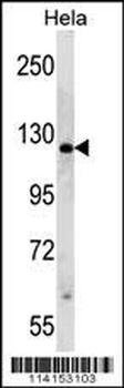 PARP1 Antibody (N-term)