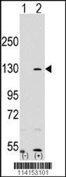 PARP1 Antibody (N-term)