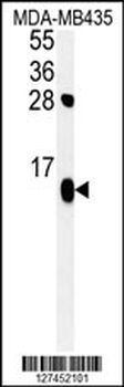 ATP5D Antibody (N-term)