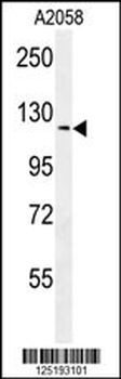 NCKAP1 Antibody (Center)