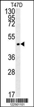 PENK Antibody (Center)