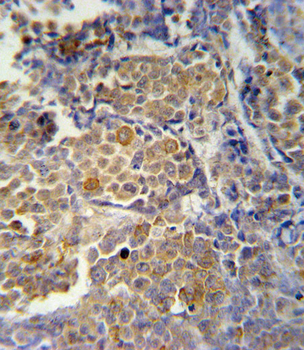 KIR2DS2 Antibody (Center)