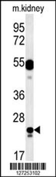 LYSMD1 Antibody (C-term)