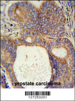 LYSMD1 Antibody (C-term)