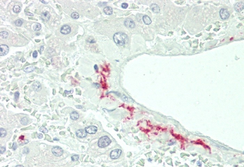 CFHR5 Antibody (Center)