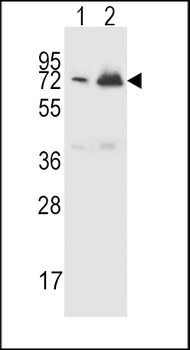 CFHR5 Antibody (Center)