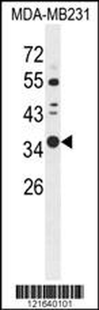 STX7 Antibody (N-term)