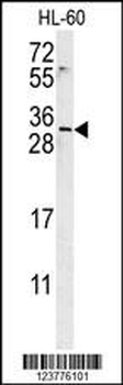 EMX2 Antibody (Center)