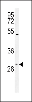 TXTP Antibody (Center)
