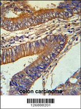 KLC3 Antibody (Center)