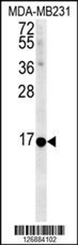 NMB Antibody (Center)