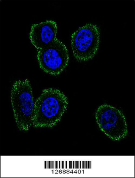 NMB Antibody (Center)