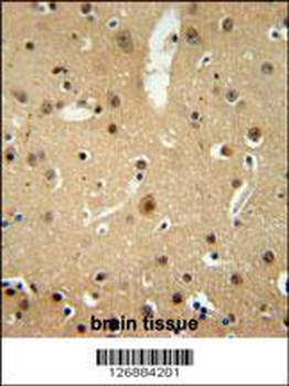 NMB Antibody (Center)