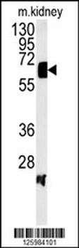 ATP6V1H Antibody (C-term)
