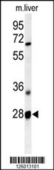RTP2 Antibody (Center)