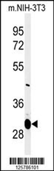 MAGT1 Antibody (N-term)