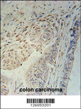 CCD92 Antibody (Center)