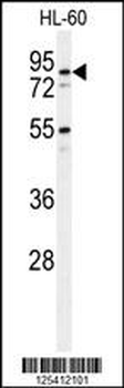 PDXD1 Antibody (C-term)