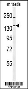 TTBK1 Antibody (N-term)