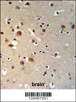 TTBK1 Antibody (N-term)