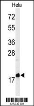 MMGT1 Antibody (C-term)
