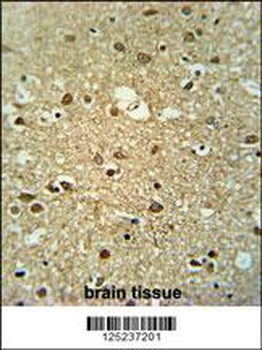 MMGT1 Antibody (C-term)