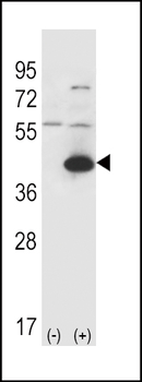 GOT1 Antibody (C-term)