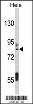 IMMT Antibody (C-term)