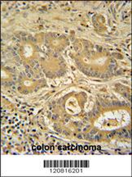IMMT Antibody (C-term)