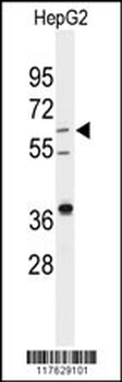 DHCR24 Antibody (Center)