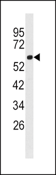 ACSL3 (FACL3) Antibody (N-term)