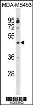 OPRK1 Antibody (Center)