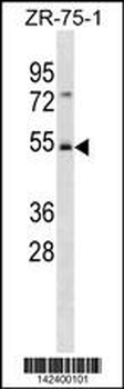 FBXW4 Antibody (C-term)