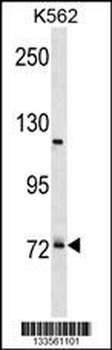 PRPF39 Antibody (C-term)
