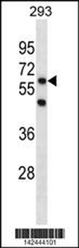 PGBD3 Antibody (N-term)