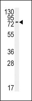 BMPR1A Antibody (N-term K36)