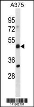 ADRM1 Antibody (C-term)