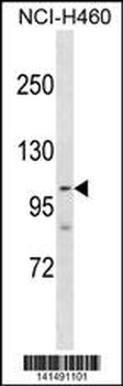 PARP1 Antibody (Center)