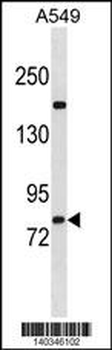 ZNF782 Antibody(N-term)