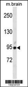 BRSK1 Antibody(Center)