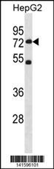 SETD3 Antibody(C-term)