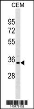 PRPS1L1 Antibody(N-term)